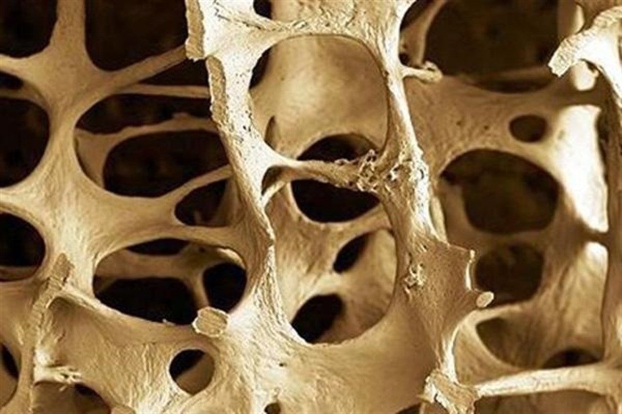 клетка кости фото